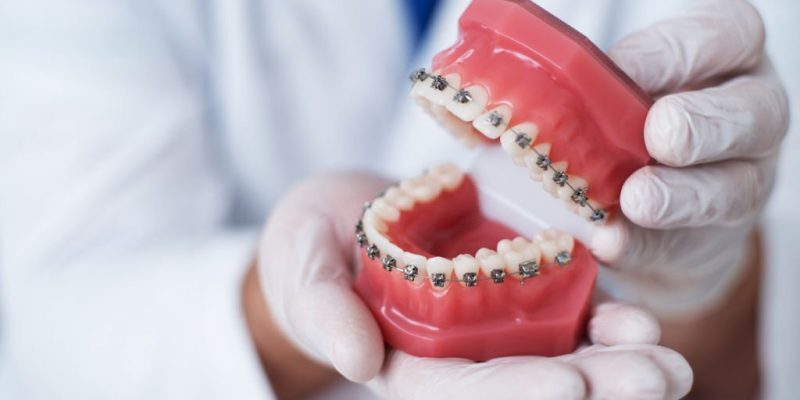 How-Can-Orthodontic-Treatment-Help-800x400