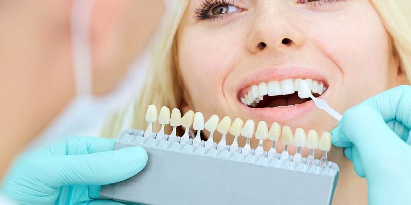 Dental-Porcelain-Crown-Should-You-Opt-For-Them-800x400