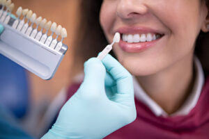 Transform Your Smile with Veneers in Garland, TX What Local Residents Need to Know