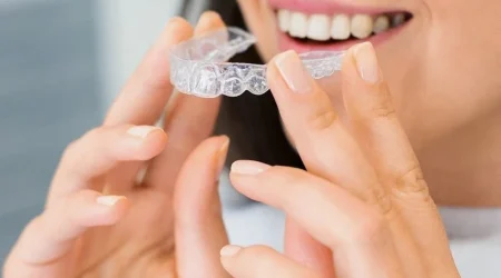 invisalign-example-img